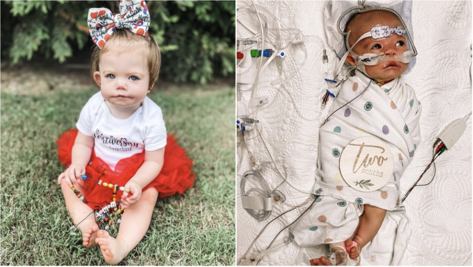 Mother of 1-year-old battling congenital heart defect raises $1,000 for treatment